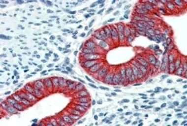Anti-EPB41L2 (aa 593 to 604) antibody, Internal used in IHC (Paraffin sections) (IHC-P). GTX88926
