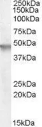 Anti-Cytohesin 2 antibody, N-term used in Western Blot (WB). GTX88930