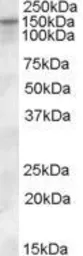 Anti-SLC12A4 antibody, Internal used in Western Blot (WB). GTX88934