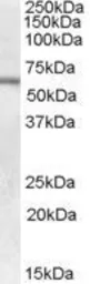 Anti-GALNS antibody, Internal used in Western Blot (WB). GTX88941