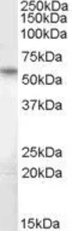 Anti-BRUNOL5 antibody, Internal (near the N-term) used in Western Blot (WB). GTX88942