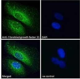 Anti-FGF21 antibody, Internal used in Immunocytochemistry/ Immunofluorescence (ICC/IF). GTX88943