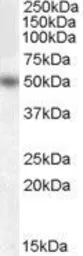 Anti-EGR4 antibody, Internal used in Western Blot (WB). GTX88944