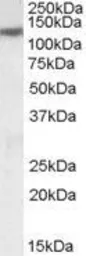 Anti-SLC12A6 antibody, Internal used in Western Blot (WB). GTX88947