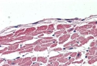Anti-SLC12A6 antibody, Internal used in IHC (Paraffin sections) (IHC-P). GTX88947