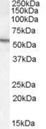 Anti-Arylsulfatase A antibody, Internal used in Western Blot (WB). GTX88953