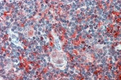 Anti-CADM4 antibody, Internal used in IHC (Paraffin sections) (IHC-P). GTX88956