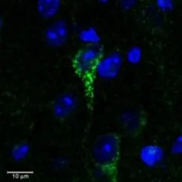 Anti-CRHR1 (aa 107 - 117) antibody, Internal used in Immunohistochemistry (IHC). GTX88961