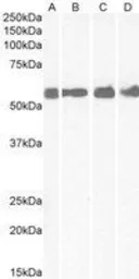 Anti-CRHR1 (aa 107 - 117) antibody, Internal used in Western Blot (WB). GTX88961