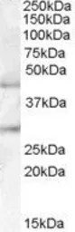 Anti-B3GNT2 antibody, Internal used in Western Blot (WB). GTX88963