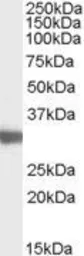 Anti-Lactate Dehydrogenase C (aa 217 - 231) antibody, Internal used in Western Blot (WB). GTX88966