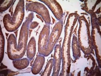 Anti-Lactate Dehydrogenase C (aa 217 - 231) antibody, Internal used in IHC (Paraffin sections) (IHC-P). GTX88966