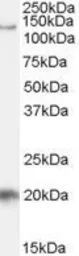 Anti-HTATSF1 antibody, Internal (near the N-term) used in Western Blot (WB). GTX88971