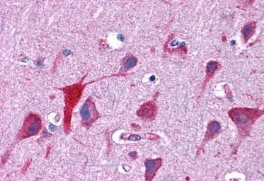 Anti-TPD52L2 antibody, C-term used in IHC (Paraffin sections) (IHC-P). GTX88975