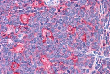 Anti-TPD52L2 antibody, C-term used in IHC (Paraffin sections) (IHC-P). GTX88975