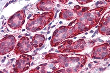 Anti-Thyroid Hormone Receptor alpha antibody, Internal used in IHC (Paraffin sections) (IHC-P). GTX88977