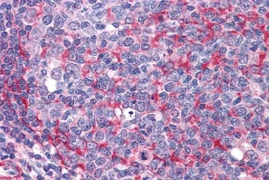 Anti-Thyroid Hormone Receptor alpha antibody, Internal used in IHC (Paraffin sections) (IHC-P). GTX88977