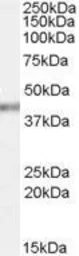Anti-PCBP4 antibody, C-term used in Western Blot (WB). GTX88982