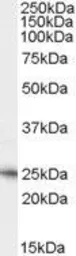 Anti-Neurturin antibody, C-term used in Western Blot (WB). GTX88984