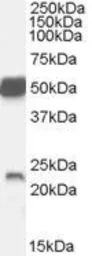 Anti-Neurturin antibody, C-term used in Western Blot (WB). GTX88985