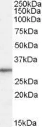 Anti-RPL8 antibody, Internal used in Western Blot (WB). GTX88990