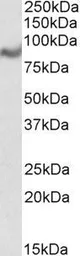 Anti-MIC1 antibody, Internal used in Western Blot (WB). GTX88992