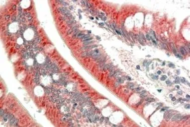Anti-MIC1 antibody, Internal used in IHC (Paraffin sections) (IHC-P). GTX88992