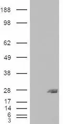 Anti-SAR1B antibody, Internal used in Western Blot (WB). GTX88997