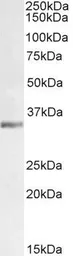 Anti-Lactate Dehydrogenase C (aa 221 - 233) antibody, Internal used in Western Blot (WB). GTX89002