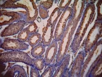 Anti-Lactate Dehydrogenase C (aa 221 - 233) antibody, Internal used in IHC (Paraffin sections) (IHC-P). GTX89002