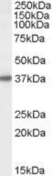 Anti-BPNT1 antibody, C-term used in Western Blot (WB). GTX89004