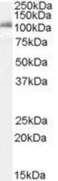 Anti-IDE antibody, Internal used in Western Blot (WB). GTX89007