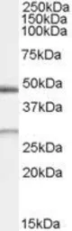 Anti-BNIP1 antibody, Internal used in Western Blot (WB). GTX89008