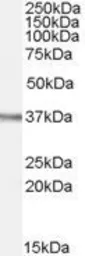 Anti-Ogg1 antibody, Internal used in Western Blot (WB). GTX89012