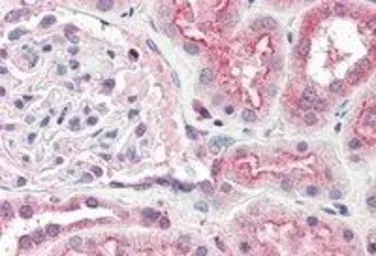 Anti-Ogg1 antibody, Internal used in IHC (Paraffin sections) (IHC-P). GTX89012