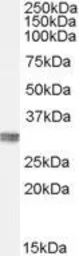 Anti-CLIC4 antibody, N-term used in Western Blot (WB). GTX89013