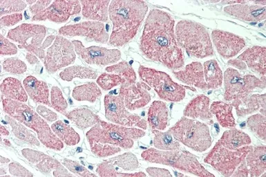 Anti-CLIC4 antibody, N-term used in IHC (Paraffin sections) (IHC-P). GTX89013