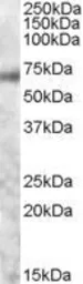 Anti-c-Myb (aa281-294) antibody, Internal used in Western Blot (WB). GTX89014