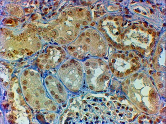 Anti-c-Myb (aa281-294) antibody, Internal used in IHC (Paraffin sections) (IHC-P). GTX89014