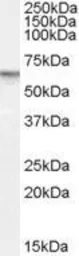 Anti-PDE11A antibody, Internal used in Western Blot (WB). GTX89018