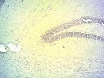 Anti-DIO2 antibody, Internal used in IHC (Frozen sections) (IHC-Fr). GTX89019