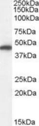 Anti-Fumarate hydratase antibody, Internal used in Western Blot (WB). GTX89022