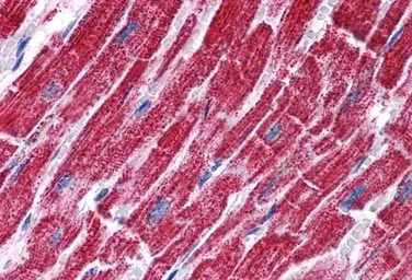 Anti-Fumarate hydratase antibody, Internal used in IHC (Paraffin sections) (IHC-P). GTX89022
