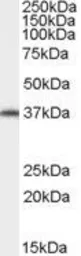 Anti-ARA9 antibody, C-term used in Western Blot (WB). GTX89023
