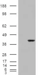Anti-ARA9 antibody, C-term used in Western Blot (WB). GTX89023