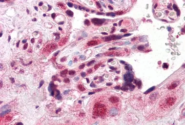 Anti-ARA9 antibody, C-term used in IHC (Paraffin sections) (IHC-P). GTX89023