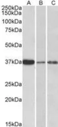 Anti-IL12B / IL12 p40 antibody, Internal used in Western Blot (WB). GTX89024