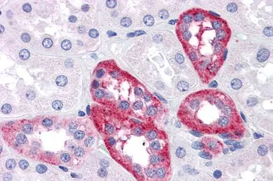 Anti-APH1A antibody, Internal used in IHC (Paraffin sections) (IHC-P). GTX89025