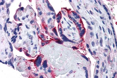 Anti-APH1A antibody, Internal used in IHC (Paraffin sections) (IHC-P). GTX89025