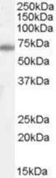 Anti-Ku70 antibody, N-term used in Western Blot (WB). GTX89026